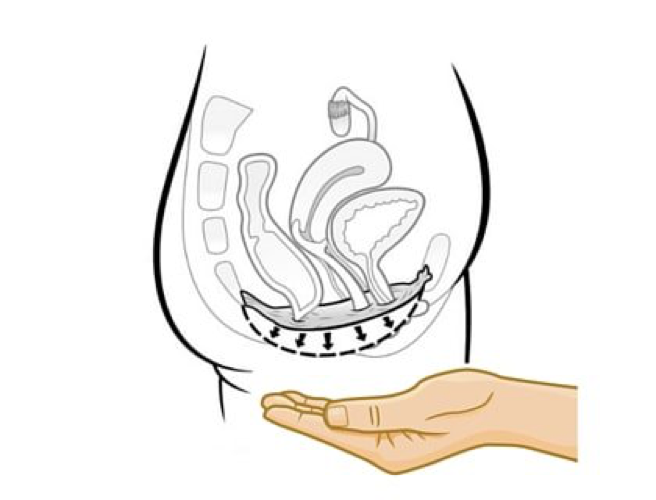 diagram of pelvic floor